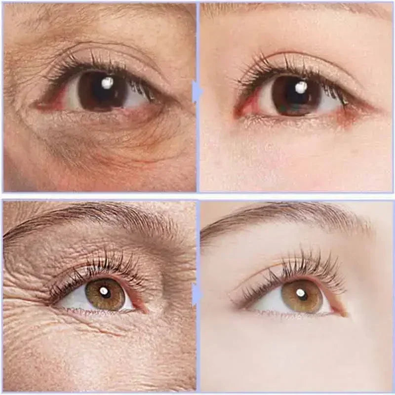 Instant Eye Cream For Anti Aging Dark Circles
