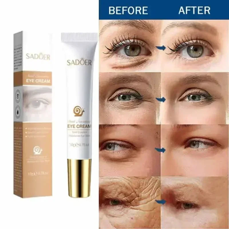 Instant Eye Cream For Anti Aging Dark Circles