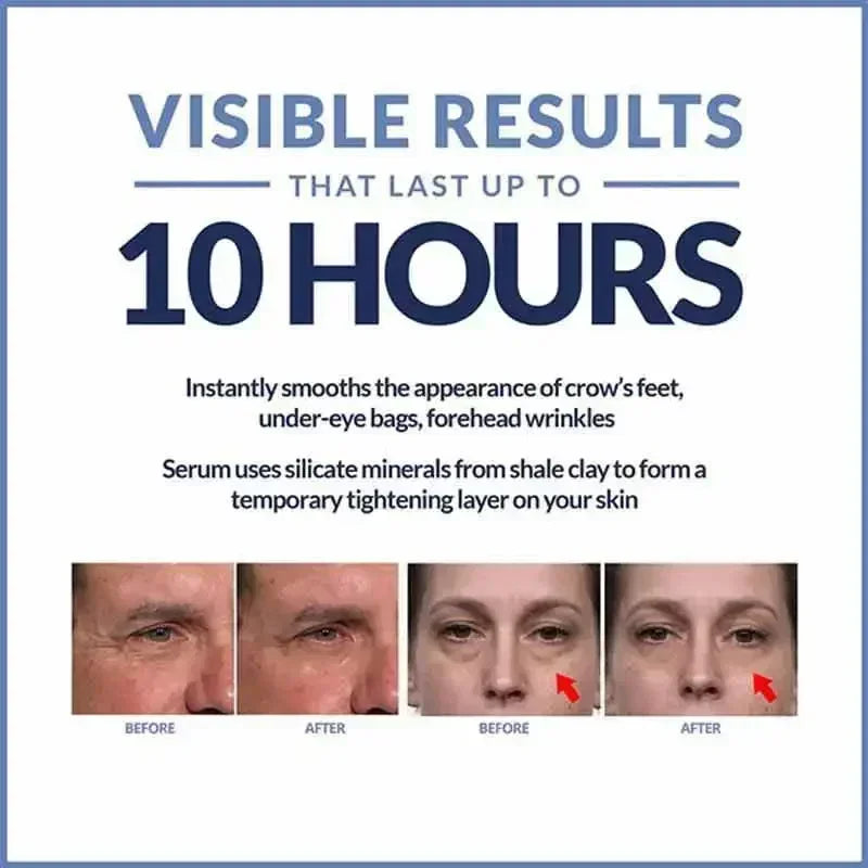 Instant Eye Cream For Anti Aging Dark Circles