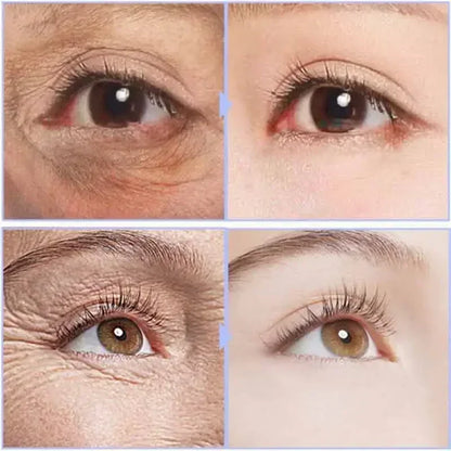 Instant Eye Cream For Anti Aging Dark Circles