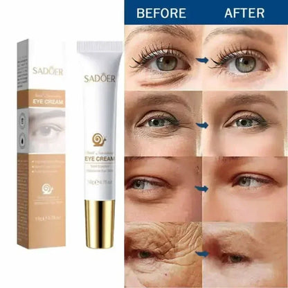 Instant Eye Cream For Anti Aging Dark Circles
