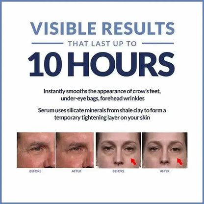 Instant Eye Cream For Anti Aging Dark Circles